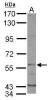 DYRK1B antibody
