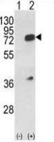 hnRNP L antibody, Internal