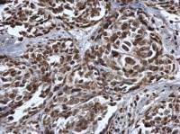 p53 (mono-methyl Lys372) antibody