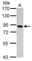 PNPLA8 antibody