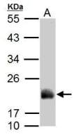 ADI1 antibody