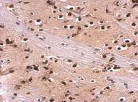 MEF2A antibody [C2C3], C-term