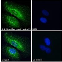 FGF21 antibody, Internal