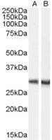 Dcdc2a antibody, Internal