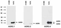 AGR3 antibody [AGR3.2]