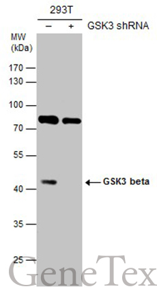 GSK3 beta antibody [C1C3]