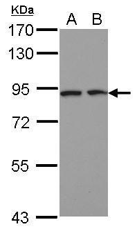 DCBLD2 antibody