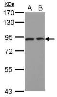DCBLD2 antibody