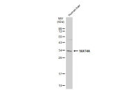 SIAT4A antibody