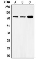 FOXO1 (phospho Ser319) antibody