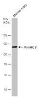 Pumilio 2 antibody [C2C3], C-term