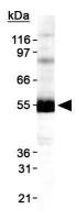 DGAT1 antibody