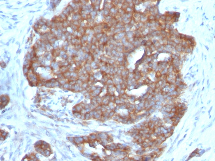 TFF1 antibody [SPM573]
