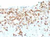 p75 NGF Receptor / CD271 antibody [NGFR/1964]