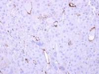 HECA antibody [C1C3]