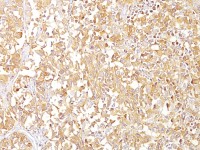 Melanoma gp100 antibody [SPM142]