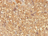 Alpha fetoprotein / AFP antibody [MBS-12]