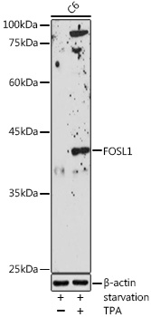 FRA1 antibody
