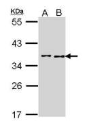 BCCIP antibody