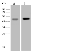 Galactosidase alpha antibody [08]