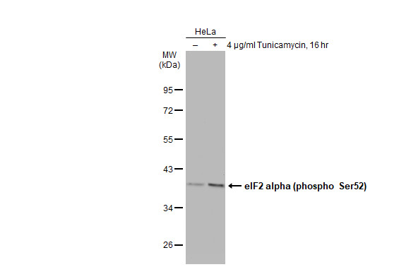 eIF2 alpha (phospho Ser51) antibody