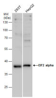 eIF2 alpha antibody