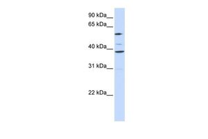 SLC25A16 antibody, Internal