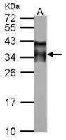 Acrosomal vesicle protein antibody