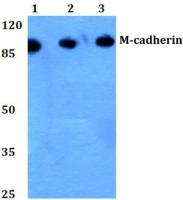 M-Cadherin antibody