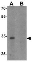 CBX4 antibody