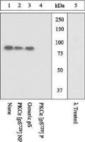 PKC epsilon (phospho Ser729) antibody