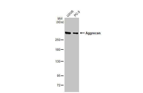 Aggrecan antibody [GT1267]