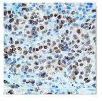 MITF antibody [C5]