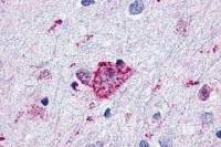 Glucagon like peptide 2 receptor antibody