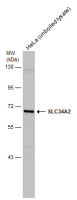 SLC34A2 antibody