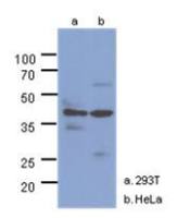 NAGK antibody [AT4D12]