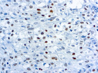 Myogenin antibody [F5D]