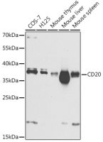CD20 antibody