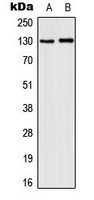 IL3 Receptor beta (phospho Tyr593) antibody