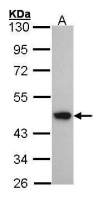ACADM antibody