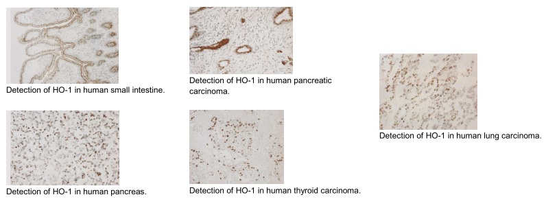Heme Oxygenase 1 antibody [GTS-1]