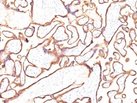 Placental Alkaline Phosphatase antibody [PL8-F6]