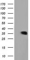 GRHPR antibody [4H2]