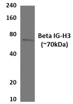TGFBI antibody [30G12]