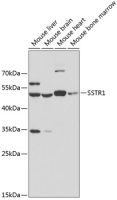 Somatostatin receptor 1 antibody