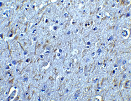 GDNF Receptor alpha 1 antibody