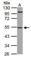 NAB1 antibody