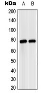 MASP2 antibody