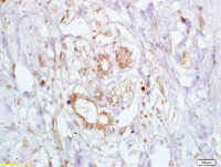 BRCA2 antibody