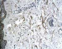 Collagen VII antibody